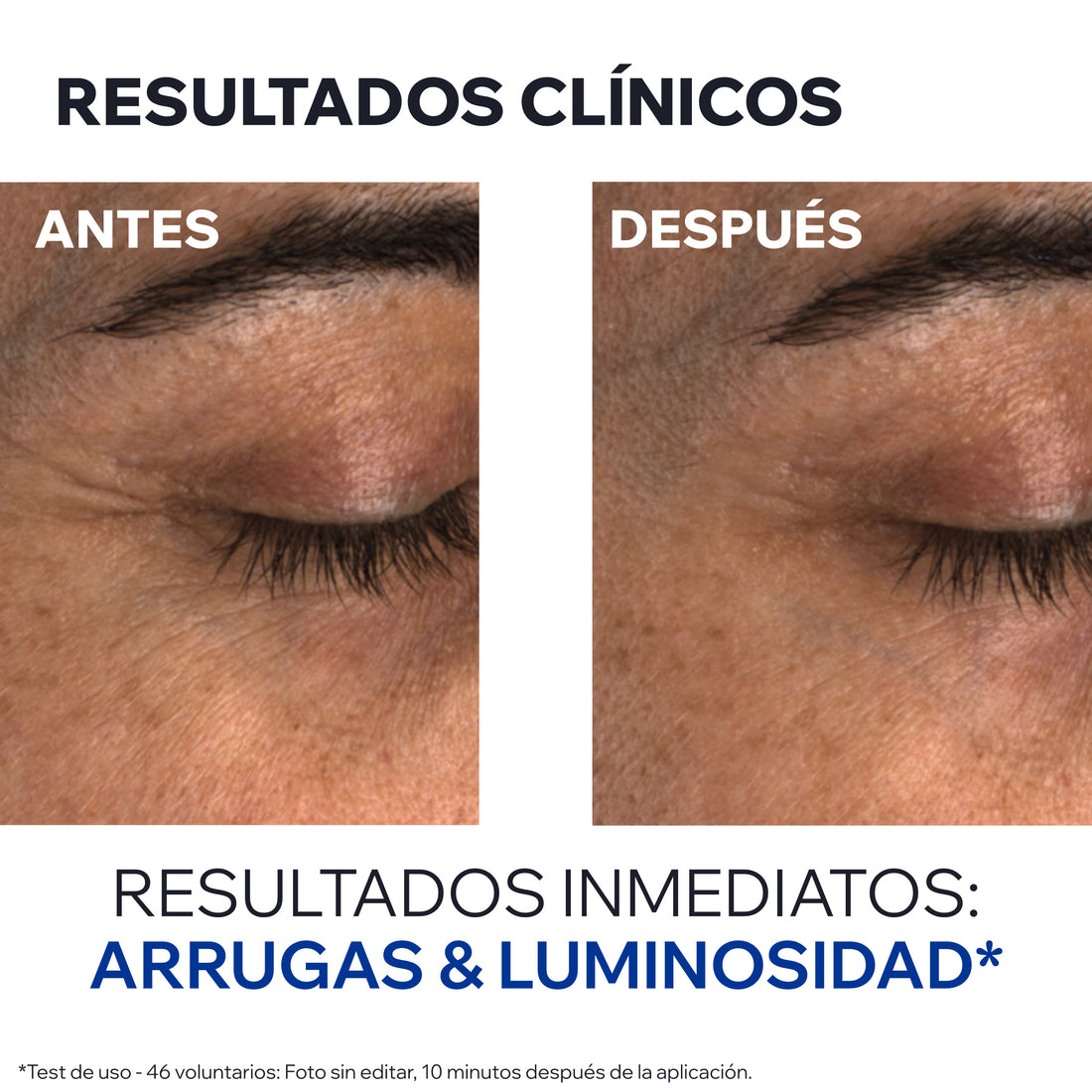Contorno de Ojos Age Absolu 15ml